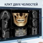 Современный томограф для проведения КЛКТ двух челюстей